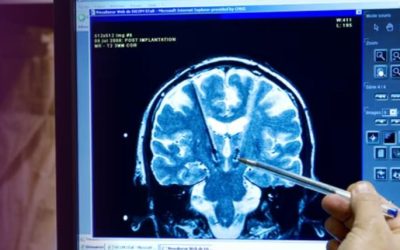 DNS-változással is járhat a gyermekkori trauma